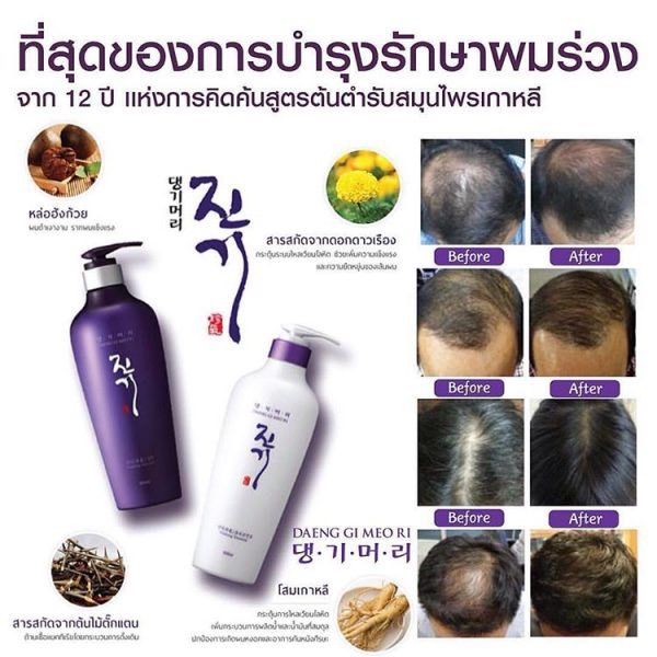 รวม-5-สูตร-daeng-gi-meo-ri-แทงกีโมรี-สุดคุ้มขวดใหญ่สุด-แชมพูและครีมนวดลดผมร่วง-ยอดขายอันดับ-1-ในเกาหลี