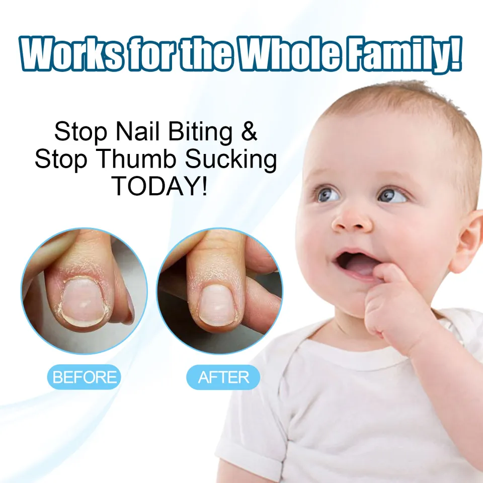 Details more than 142 nail biting benefits super hot songngunhatanh