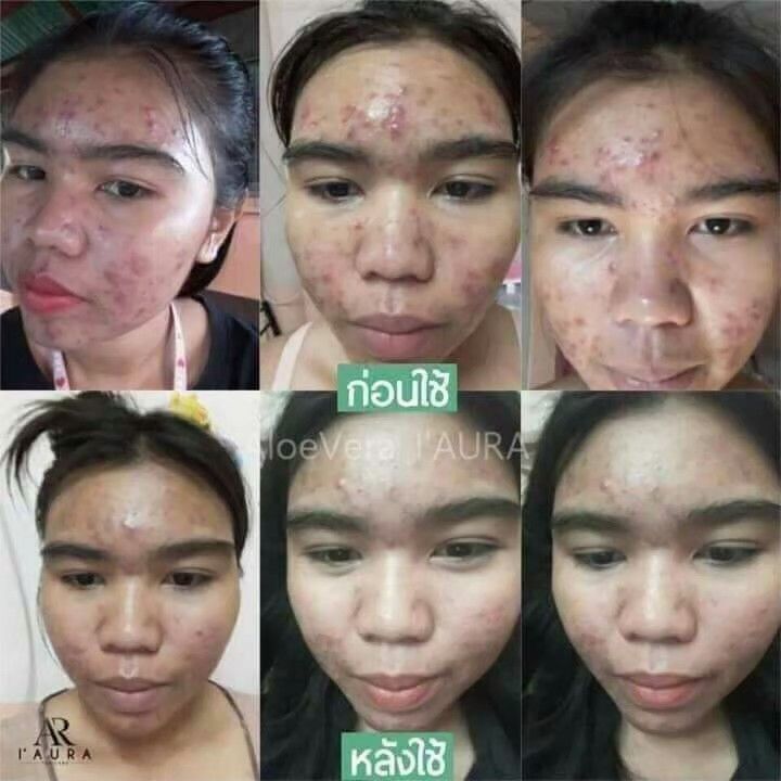 แพ็คเกจใหม่-i-aura-aloe-vera-cleansing-gel-เจลล้างหน้าว่านหางจระเข้-คลีนซิ่ง-50-g