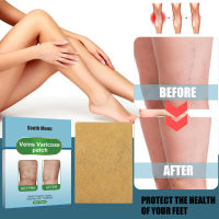 South Moon Leg Vein Nursing Adhesive Bandage Tendons Relaxing And Activating Plaster Muscles And Bones Leg Massage Nursing Adhesive Bandage