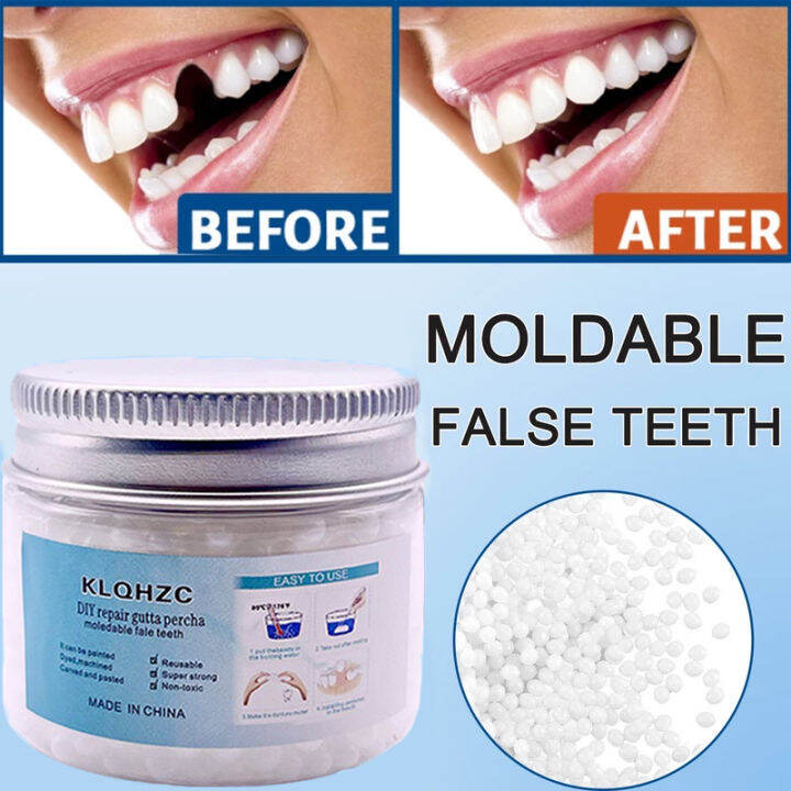 DIY Tooth Repair Kit Teeth Filling Solid Glue Temporary Teeth