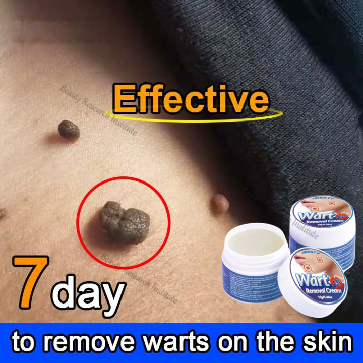 Original Wart Removal Cream Fast Remove Skin Tag Remover Ointment