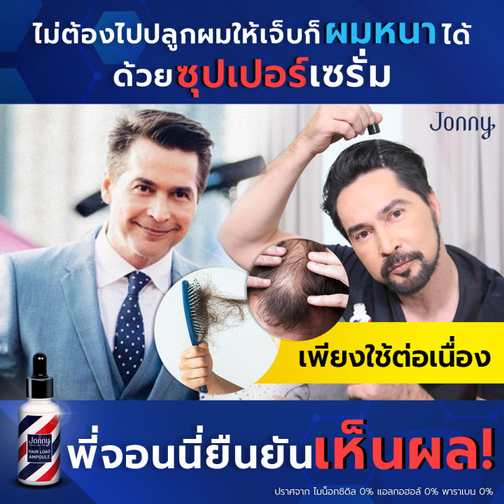 จอนนี่-แอมเพิล-ปลูกผม-จอนนี่-แอมเพิล-jonny-แอมเพิล-jonny-hair-load-jonny-ampoule-jonny-hair-load-ampoule-จอนนี่-แอนโฟเน