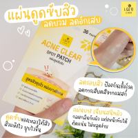 แผ่นดูดซับสิวยุบไว ไม่ทิ้งรอย เฌอ Acne clear spot patch แผ่นดูดซับสิว 1 กล่องมี 36 ชิ้น CHER SKINCARE