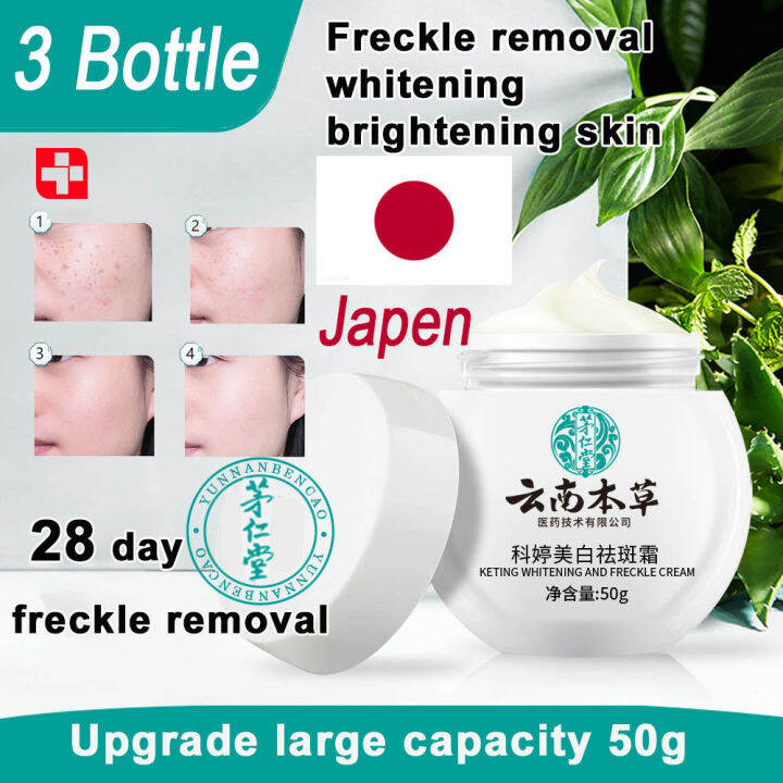 Ready Stock Original Melasma Cream Japanese Freckle Cream Yunnan Herbal Whitening High 2163