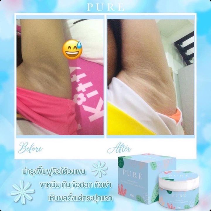 pure-ครีมเพียว-ครีมทาใต้วงแขน-รักแร้เพียวขาว-เนียน-pure-underarm-cream