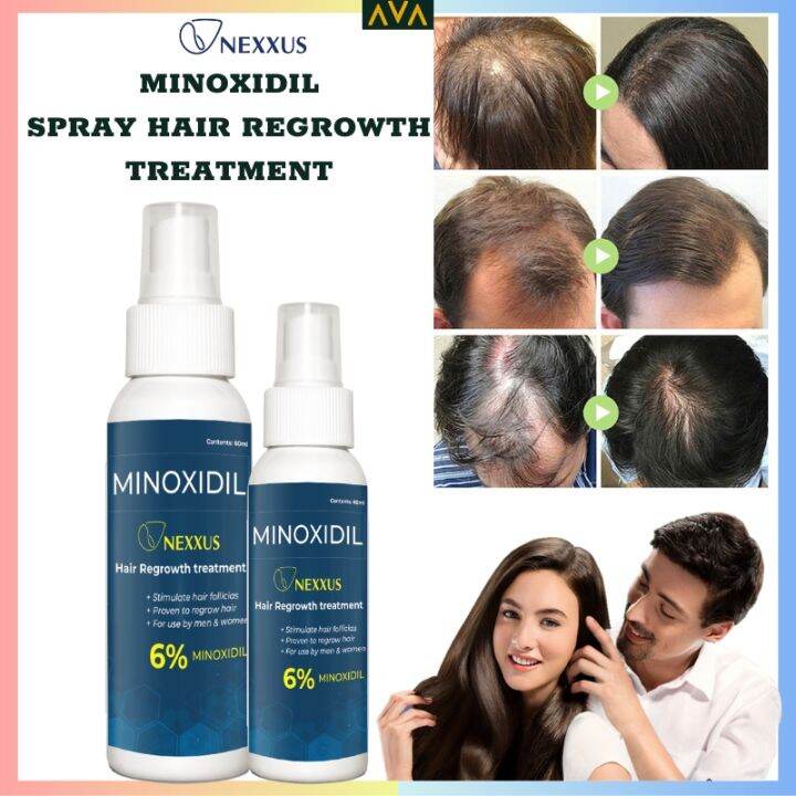 AJDL sell Minoxidil Hair Grower NEXXUS Minoxidil spray regrowth ...