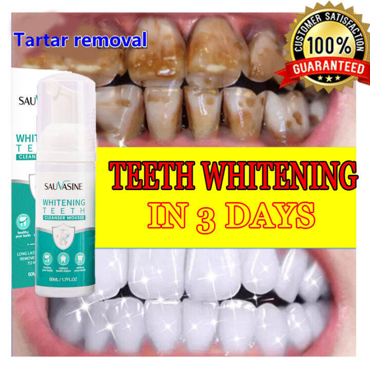 Toothpaste whitening teeth whitening stain removal Teeth whitening