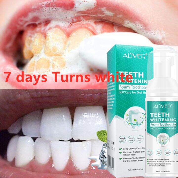 Original ALIVER Teeth Whitening Mousse Toothpaste 60ML Teeth Whitening