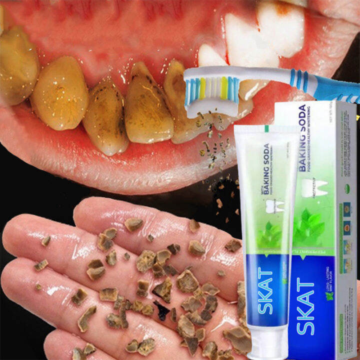🦷Baking soda toothpaste🦷 whitening Toothpaste 180g whitening teeth and