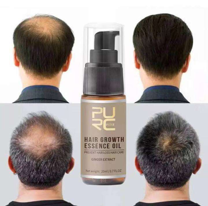 Purc 100 Pure Natural Hair Growth Essence Oil Ginger Hair Treatment Purc 100 Pure Natural Hair Growth Essence Oil Ginger Hair Treatment