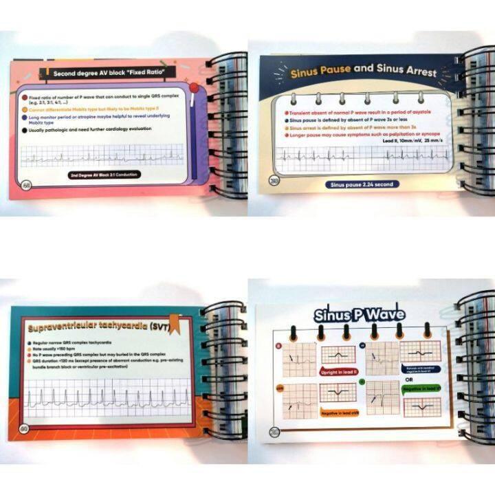 ขายดี-หนังสือ-a-beginners-plearn-with-ekg-electrocardiography-ezy-card-the-review-book-of-practical-ecg-ตำราแพทย์-บริการเก็บเงินปลายทาง