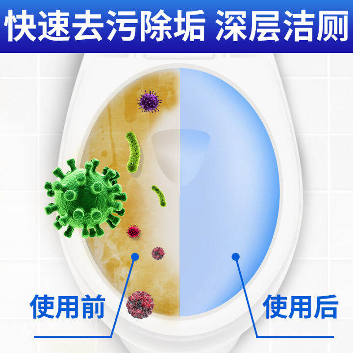 german-toilet-effervescent-tablets-toilet-strong-detergent-cleaning-bar-deodorant-toilet-urine-stains-toilet-cleaner-yellow-and-deodorant