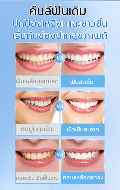 ขายดี-เกลือทะเลเบคกิ้งโซดายาสีฟัน110g-กลิ่นปากสดชื่น-ยาสีฟันมิ้นต์-กำจัดคราบฟัน-คราบฟัน-ยาสีฟันขจัดหิน-ยาสีฟันฟันขาว-ยาสีฟันขจัดปูน-น้ำยาขัดฟันขาว-ขจัดคราบหินปูน-ยาสีฟันฟอกขาว-น้ำยาฟอกสีฟัน-ฟอกสีฟัน-ค