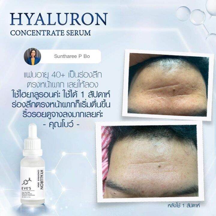 ส่งฟรี-เซตขายดี-เซตคู่-ขาวฟูเด้ง-x2-อีฟส์-ครีมบำรุงหน้าขาวใส-ลดรอยสิว-กระชับรูขุมขน-ครีมเจล-อีฟส์-เซรั่มไฮยา