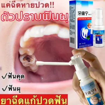 ยาแก้ปวดฟัน ฟันผุ สเปรย์ ราคาถูก ซื้อออนไลน์ที่ - พ.ย. 2023 | Lazada.Co.Th