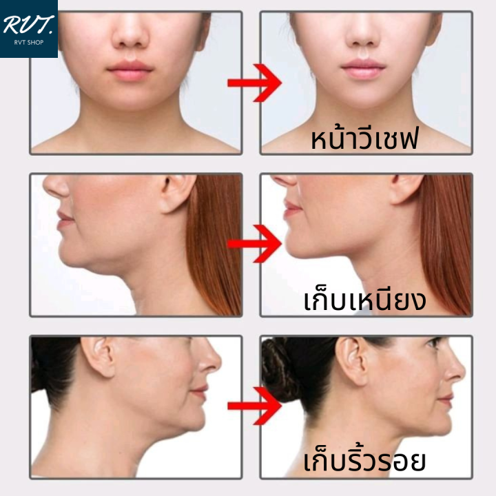 สติ๊กเกอร์หน้าเรียว-เทปดึงหน้า-ลดเหนียง-nbsp-1-กล่องมี-40-ชิ้น