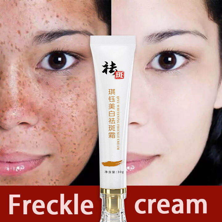 Whitening anti-freckle cream repair dark spots whiten brighten (30g ...