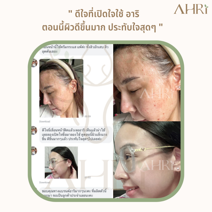 ahri-organic-acne-pro-serum-30ml-เซรั่มเคลียร์สิว-จากเภสัชกร-สูตรออร์แกนิค-อ่อนโยน-ใช้ได้แม้ผิวแพ้ง่าย