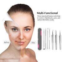 【cw】 Wholesale Needle 4pcs Remover Pull out Pimples Face Deep Acne Granules