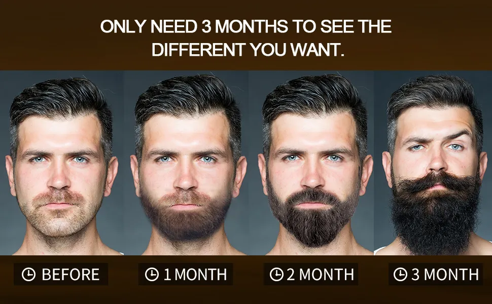 POP Beard Growth Oil With Biotin Caffeine for Men Beard Growth Serum Stimulate Beard Growth Promote Hair Regrowth Facial Hair Treatment Full Longer Masculine Thick Male Beard Gift 30ml | Lazada POP Beard Growth Oil With Biotin Caffeine for Men Beard Growth Serum Stimulate Beard Growth Promote Hair Regrowth Facial Hair Treatment Full Longer Masculine Thick Male Beard Gift 30ml | Lazada