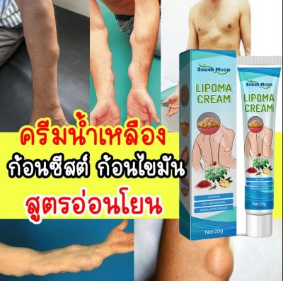 บรรเทาปูนปลาสเตอร์ผิวบวมครีมก้อนใต้ผิวหนัง สารสกัดจากพืชธรรมชาติ Lipoma Treatment Balm กำจัดเนื้องอกผิวหนังบวม ทาแก้ปวด บำรุงผิวกายเซลลูไลท์