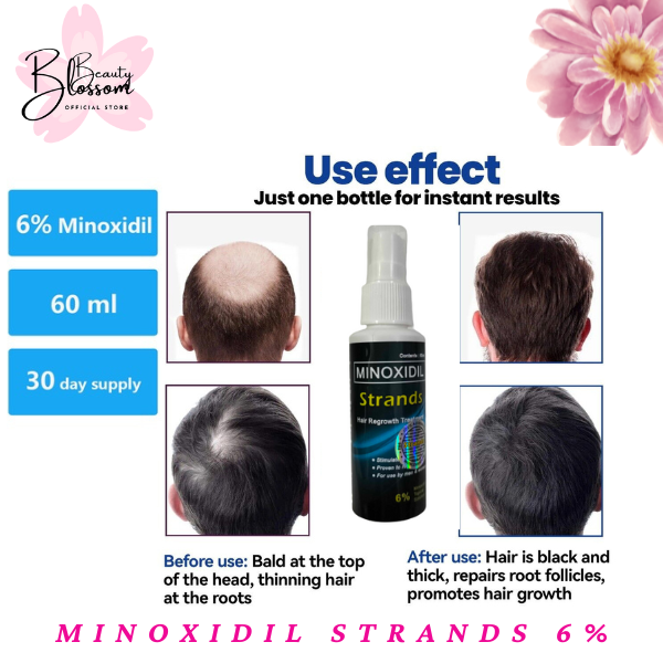 Strands Minoxidil 6% Topical Solution for Menand Women 60ml Hair Grower ...