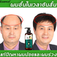 【สินค้าขายดีเป็นพิเศษ】ZHENSHOW แชมพูแก้ผมร่วง 500ml ป้องกันผมร่วง ผมแน่น ผมเพิ่ม ป้องกันรังแค ป้องกันอาการคัน ควบคุมความมัน ชี้ฟู (แชมพูขิงเพียว ยาสระผมขิง แชมพูขิง ยาสระผมแก้ร่วง แชมพูปลูกผมดก แชมพูลดผมร่วง แชมพูสมุนไพร แชมพูเร่งผมยาว) Ginger shampoo