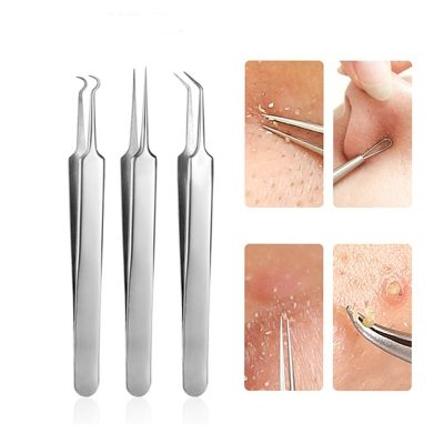 【cw】 3 Pcs/set Acne Needle Blackhead Blemish Pimples Removal Pointed Bend Gib Face Tools Comedone Extractor ！