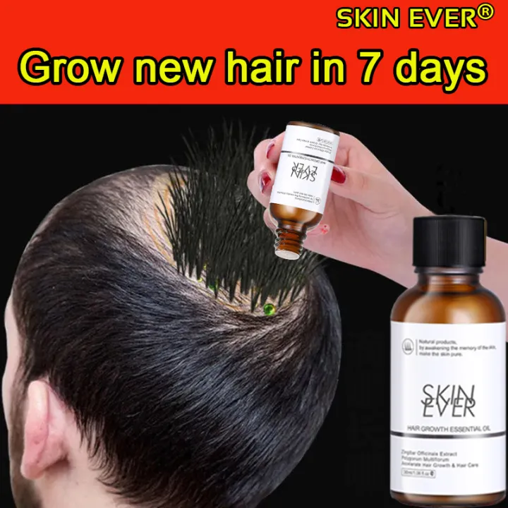 Hair volume increased by 10 times SKIN EVER Hair growth spray Hair growth  essence Hair care