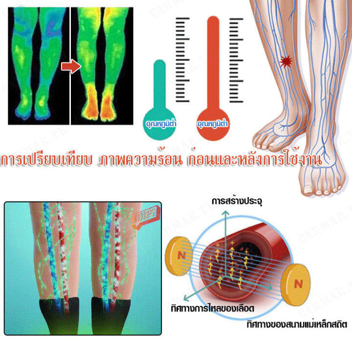 carmar-นักกีฬาชายหญิง-อุปกรณ์ป้องกันช่วยเหลือการบาดเจ็บข้อเท้า