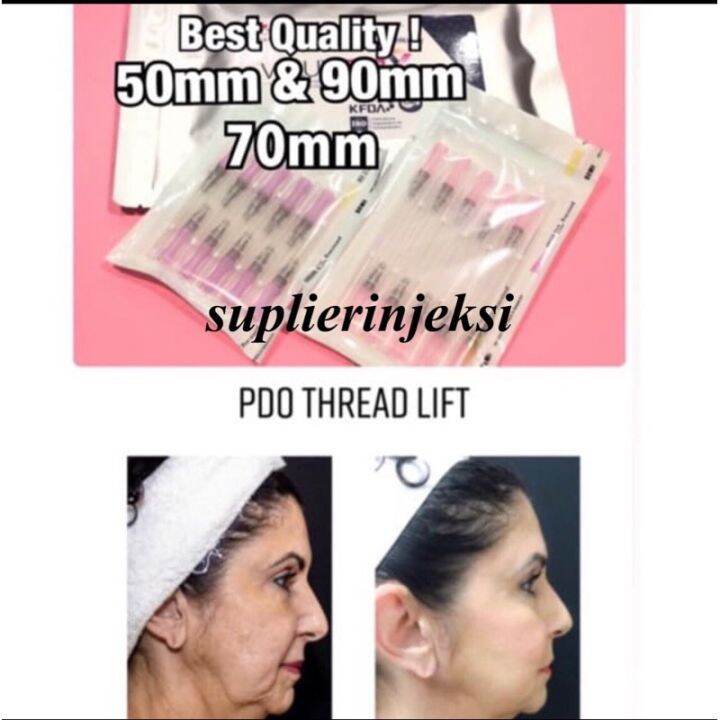 MONO PDO Thread Lift Tanam Benang Wajah Lifting Face korea Lazada