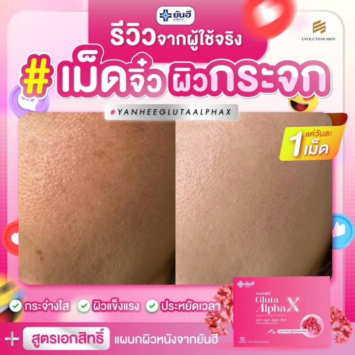 ส่งฟรีด่วนใน1วัน-yanhee-gluta-alpha-x-ยันฮี-กลูต้า-อัลฟ่า-เอ็กซ์-ผลิตภัณฑ์เสริมอาหารจากยันฮี