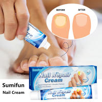 Sumifun Nail Repair Cream ครีมรักษาเล็บที่มีประสิทธิภาพ Anti Fungal Remove Onychomycosis Nourishing Nails Care Ointment 20G