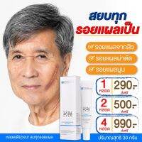 SkinEver คีลอยด์ลบแผลเป็น แผลนูน แผลผ่าตัด แผลน้ำร้อนลวก ขนาด 30 ML 1 หลอด