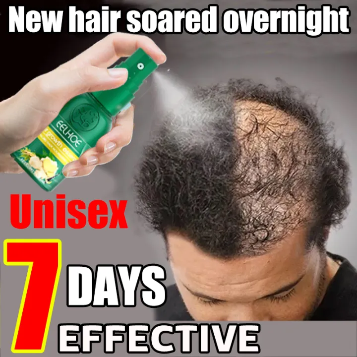 7 days to grow new hair Spray Preventing ginger raw material Baldness  Consolidating Anti Hair Loss