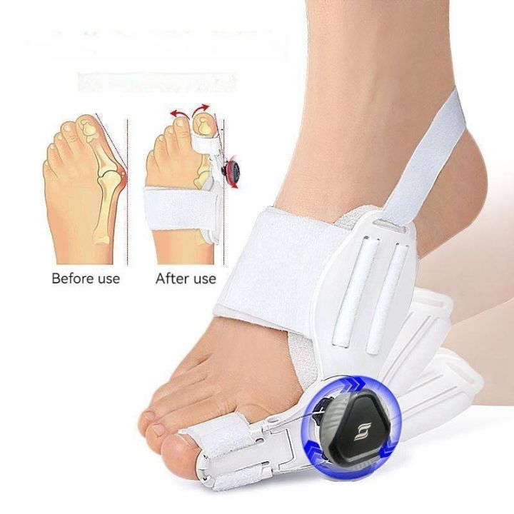 1pcs-bunion-splint-big-toe-straightener-corrector-hallux-valgus-adjustable-knob-correction-orthopedic-bone-thumb-adjuster