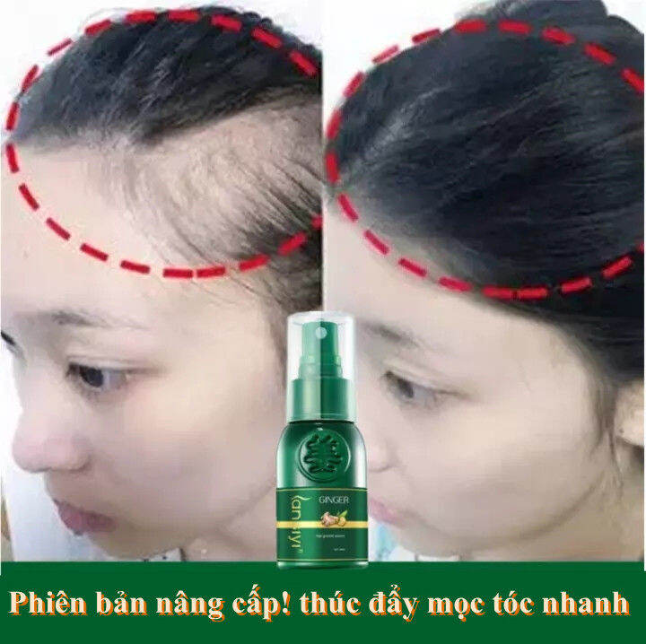 Tinh chất tóc gừng tự nhiên là một sản phẩm chăm sóc tóc tuyệt vời cho những ai muốn tóc luôn khỏe, mềm mượt và bóng mượt. Tinh chất này giúp củng cố chất đàn hồi của tóc, hạn chế rụng tóc và kích thích mọc tóc. Hãy xem hình ảnh liên quan để khám phá tác dụng kỳ diệu của tinh chất tóc gừng tự nhiên này.