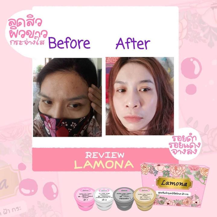 ส่วนลดพิเศษ-ส่งฟรี-ครีมลาโมน่า-lamona-cream-บำรุงผิวหน้า-ของแท้-100-chompoo-bella-shop-อย่าลืมกดรับคูปองก่อนสั่งด้วยนะคะ