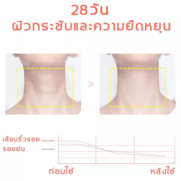 rtoprครีมทาคอ-ยกกระชับ-ผิว-ต่อต้านความแก่-ครีมบำรุง-ผิวคอ-ลด-เลือน-ริ้วรอย-ครีมไวท์เทนนิ่ง-ให้ความชุ่มชื้น-ครีมทาคอ-r15