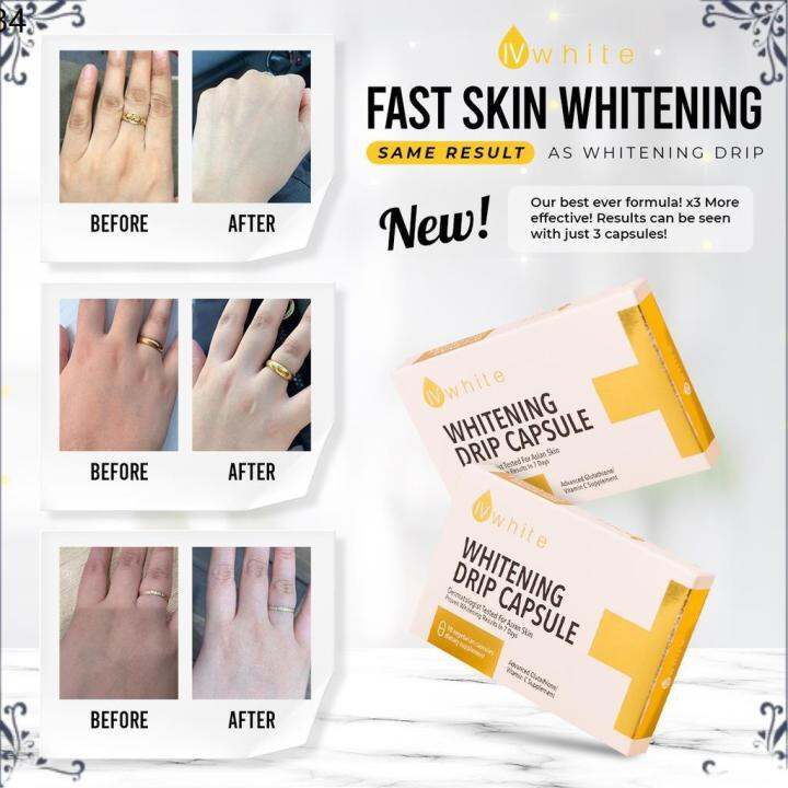 【100 Original】 IvWhite KOREA Whitening Drip Capsule Supplement (HIGHLY