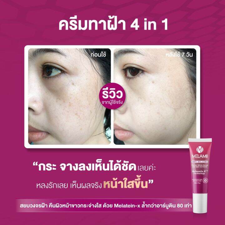 2-หลอด-melamii-anti-melasma-perfect-white-serum-เมลามิ-เซรั่ม-8-g-ลดเลือนฝ้า-กระ-ทาฝ้า