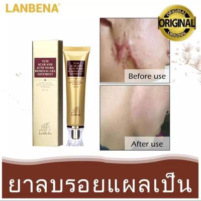 【ซื้อ1แถม1 】Lanbena ยาลบลอยแผลเป็น คีลอยด์ รอยแดง หลุมสิว ลายท้องหลังคลอด และฟื้นฟูสภาพผิวให้แลดูเรียบเนียนอย่างเป็นธรรมชาติ ครีมลบลอยแผลเป็น รักษาคีลอยด์ ลบรอยแดง ลดหลุมสิว ลบลายท้องหลังคลอดเมื่อใช้เป็นประจำ!!!ขนาด 30 กรัม