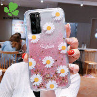 เพื่อเป็นเกียรติแก่30 Proเคสโทรศัพท์น่ารักการ์ตูนเคสโทรศัพท์มีลายเคสโทรศัพท์ของเหลวแบบไดนามิกดูดทรายเคสซิลิโคน