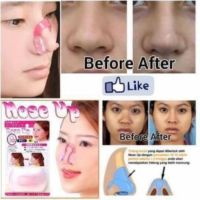 【health】 NOSE UP (Nose Lifting Clip)