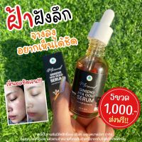 ?เซรั่มโสมทองไฮยา เมอเมด 30 ml. ((โปร 3 ขวด))เซรั่มกู้หน้าพัง จาก จุดด่างดำของสิว หน้าเป็นฝ้า กระ ให้ขาวกระจ่างใส (ส่งฟรี)