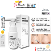 Ủ Mụn Remove Blackheads đẩy nhân mụn đầu đen làm sạch bã nhờn