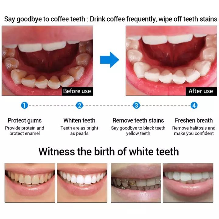 มูสแปรงฟัน-แก้ฟันเหลือง-ขัดฟันขาว-แก้ฟันเหลือง-คราบชากาแฟ-แก้กลิ่นปากเหม็น-เหมาะสำหรับทุกคน-ยาสีฟัน-teeth-whitening-1737