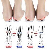 1 Pair Magnet Silicon Orthopedic Insoles Foot Care Tool For Men Women Health Care O/X Type Leg Knee Varus Correction Heel Pad Shoes Accessories