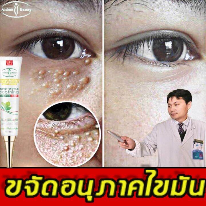 ขายดีที่สุดในรัสเซีย-aichun-เซรั่มรอบดวงตา-30ml-ครีมบำรุงรอบตา-ขจัดฟื้นฟูผิวตา-เพิ่มความชุ่มชื่น-กำจัดถุงใต้ตา-เม็ดไขมัน-ครีมบำรุงใต้ตา-ดูแลรอบดวงตา-บำรุงรอบดวงตา-ครีมบำรุงรอบดวงตา-ริ้วรอยรอบดวงตา-เซร